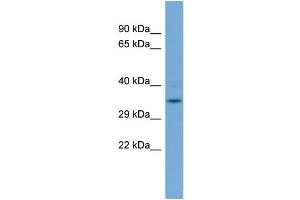 WB Suggested Anti-GLOD4  Antibody Titration: 0.