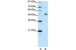 WB Suggested Anti-FOXA2 Antibody Titration:  0. (FOXA2 antibody  (C-Term))