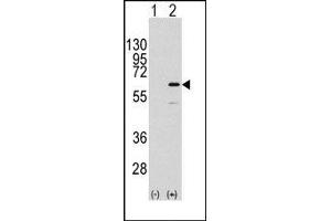 Image no. 1 for anti-ELK1, Member of ETS Oncogene Family (ELK1) (Ser383) antibody (ABIN358791) (ELK1 antibody  (Ser383))