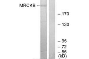 Western Blotting (WB) image for anti-CDC42 Binding Protein Kinase beta (DMPK-Like) (CDC42BPB) (AA 1641-1690) antibody (ABIN2879167) (CDC42BPB antibody  (AA 1641-1690))
