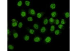 Immunocytochemistry staining of HeLa cells fixed with 4 % Paraformaldehyde and using anti-SMC1A mouse mAb(dilution 1:100). (SMC1A antibody  (C-Term))