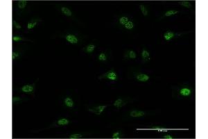 Immunofluorescence of monoclonal antibody to PLRG1 on HeLa cell. (PLRG1 antibody  (AA 101-198))