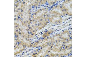 Immunohistochemistry of paraffin-embedded rat kidney using PCSK9 antibody. (PCSK9 antibody)