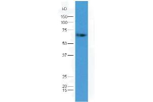 Lane 1: mouse embryo lysates probed with Rabbit Anti-GAD65 + GAD67 Polyclonal Antibody, Unconjugated (ABIN1714177) at 1:300 overnight at 4 °C. (GAD65+GAD67 (AA 351-450) antibody)