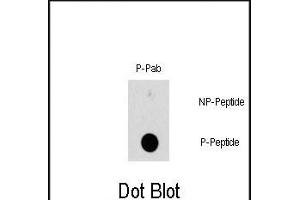Dot blot analysis of Phospho-HSBP1-S78 polyclonal antibody (ABIN389744 and ABIN2839677) on nitrocellulose membrane. (HSP27 antibody  (pSer78))
