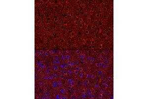 Immunofluorescence analysis of Rat brain using P2Y12 antibody (ABIN7269752) at dilution of 1:50 (40x lens). (P2RY12 antibody)