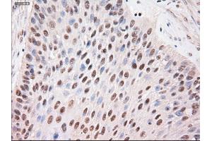 Immunohistochemical staining of paraffin-embedded kidney using anti-Stat4 (ABIN2452527) mouse monoclonal antibody. (STAT4 antibody  (AA 633-652))
