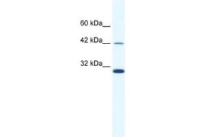 WB Suggested Anti-APOBEC3G Antibody   Titration: 2. (APOBEC3G antibody  (N-Term))