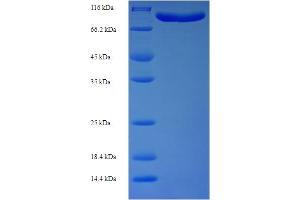 SDS-PAGE (SDS) image for DnaJ (Hsp40) Homolog, Subfamily C, Member 10 (DNAJC10) (AA 1-656), (full length) protein (His-SUMO Tag) (ABIN5709973) (DNAJC10 Protein (AA 1-656, full length) (His-SUMO Tag))