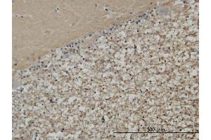 Immunoperoxidase of monoclonal antibody to STXBP1 on formalin-fixed paraffin-embedded human cerebellum. (STXBP1 antibody  (AA 74-168))