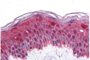 Human Skin: Formalin-Fixed, Paraffin-Embedded (FFPE) (LHX8 antibody  (AA 1-321))