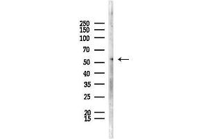 anti-Potassium Channel, Subfamily K, Member 5 (KCNK5) (C-Term) antibody