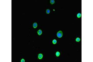 Immunofluorescent analysis of MCF-7 cells using ABIN7143597 at dilution of 1:100 and Alexa Fluor 488-congugated AffiniPure Goat Anti-Rabbit IgG(H+L) (ASIP antibody  (AA 23-112))