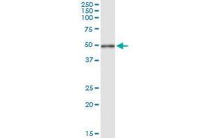 Immunoprecipitation of CYTH2 transfected lysate using anti-CYTH2 MaxPab rabbit polyclonal antibody and Protein A Magnetic Bead , and immunoblotted with CYTH2 MaxPab mouse polyclonal antibody (B01) . (Cytohesin 2 antibody  (AA 1-400))