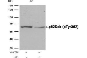 Western blot analysis of extracts from JK cells, treated with G-CSF or calf intestinal phosphatase (CIP), using p62Dok (phospho-Tyr362) Antibody. (DOK1 antibody  (pTyr362))