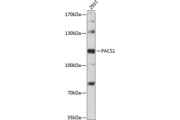 PACS1 antibody  (AA 420-560)