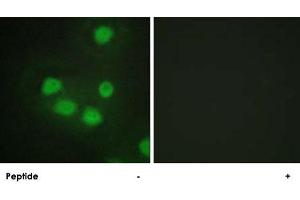 Immunofluorescence analysis of HepG2 cells, using SIX6 polyclonal antibody . (SIX Homeobox 6 antibody)