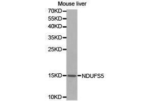 Western Blotting (WB) image for anti-NADH Dehydrogenase (Ubiquinone) Fe-S Protein 5, 15kDa (NADH-Coenzyme Q Reductase) (NDUFS5) antibody (ABIN1873864) (NDUFS5 antibody)