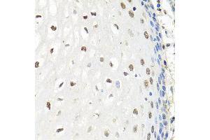 Immunohistochemistry of paraffin-embedded human esophagus using CNOT8 antibody at dilution of 1:100 (x40 lens).