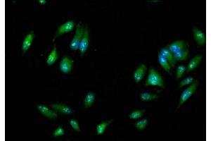 Immunofluorescence staining of Hela cells with ABIN7167480 at 1:266, counter-stained with DAPI. (RIPK3 antibody  (AA 1-518))