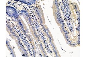 ABIN7095075 and ABIN7099131 at 1/100 staining rat colorectal tissue by IHC-P.