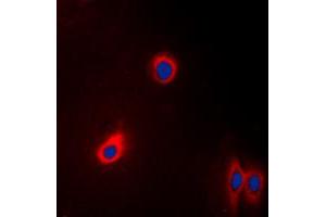 Immunofluorescent analysis of EEF2 staining in A431 cells. (EEF2 antibody  (N-Term))