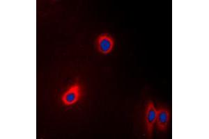 Immunofluorescent analysis of EEF2 staining in A431 cells. (EEF2 antibody  (N-Term))