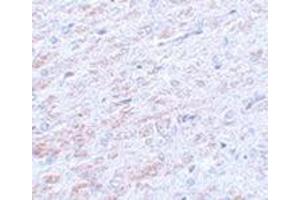 Immunohistochemistry of TCF3 in rat liver tissue with this product at 5 μg/ml. (TCF3 antibody  (N-Term))