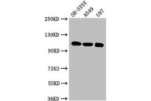 Western Blot Positive WB detected in: SH-SY5Y whole cell lysate, A549 whole cell lysate, U87 whole cell lysate All lanes: LRP8 antibody at 3 μg/mL Secondary Goat polyclonal to rabbit IgG at 1/50000 dilution Predicted band size: 106, 78, 100, 88 kDa Observed band size: 106 kDa