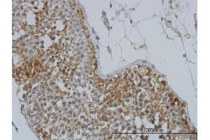 Immunostaining (ISt) image for anti-Glycogenin 1 (GYG1) (AA 1-73) antibody (ABIN561206)