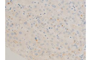 ABIN6267270 at 1/100 staining human liver tissue sections by IHC-P. (c-FOS antibody  (pSer362))