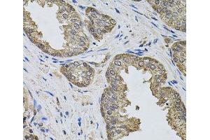 Immunohistochemistry of paraffin-embedded Human prostate using IGSF3 Polyclonal Antibody (IGSF3 antibody)