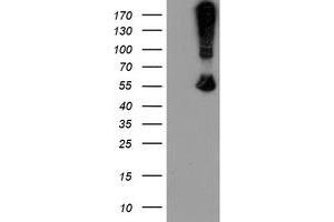 Western Blotting (WB) image for anti-rho GTPase Activating Protein 2 (ARHGAP2) antibody (ABIN1499627) (CHN1 antibody)