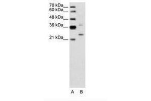 Image no. 2 for anti-Defective in Cullin Neddylation 1, Domain Containing 1 (DCUN1D1) (AA 31-80) antibody (ABIN6736642) (DCUN1D1 antibody  (AA 31-80))