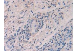 Immunohistochemistry (IHC) image for anti-Alcohol Dehydrogenase 1 (Class I) (ADH1) (AA 169-370) antibody (ABIN7432379)