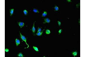 Immunofluorescent analysis of U251 cells using ABIN7149892 at dilution of 1:100 and Alexa Fluor 488-congugated AffiniPure Goat Anti-Rabbit IgG(H+L) (DEF6 antibody  (AA 20-114))