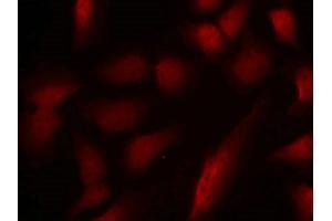 Immunofluorescence staining of methanol-fixed Hela cells using GATA1(Phospho-Ser310) Antibody. (GATA1 antibody  (pSer310))