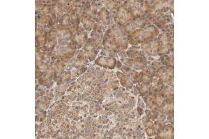 Immunohistochemical staining (Formalin-fixed paraffin-embedded sections) of human pancreas with EPS8 polyclonal antibody  shows cytoplasmic positivity in exocrine glandular cells and islet cells.