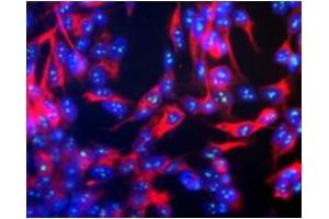 Immunofluorescence (IF) image for anti-Fibrillarin (FBL) antibody (ABIN371824) (Fibrillarin antibody)
