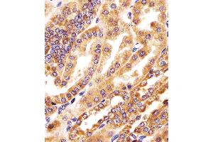(ABIN6244258 and ABIN6578390) staining GMCL1 in human kidney tissue sections by Immunohistochemistry (IHC-P - paraformaldehyde-fixed, paraffin-embedded sections). (GMCL1 antibody  (AA 281-315))
