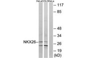 Western blot analysis of extracts from HeLa/COLO cells, using NKX26 Antibody. (NKX2-6 antibody  (AA 91-140))