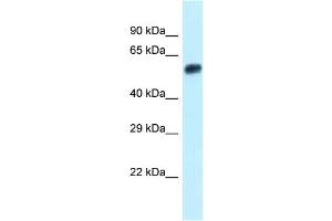 WB Suggested Anti-Eepd1 Antibody Titration: 1. (EEPD1 antibody  (N-Term))