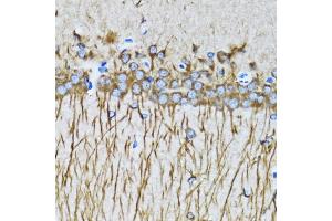 Immunohistochemistry of paraffin-embedded mouse brain using MAP1LC3A antibody.