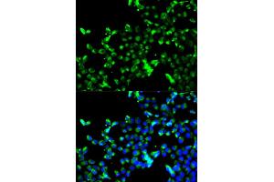 Immunofluorescence analysis of A549 cells using CALR antibody. (Calreticulin antibody)