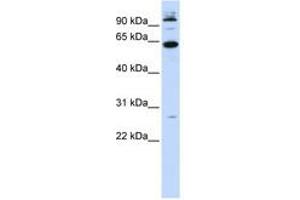 Image no. 1 for anti-MNT, MAX Dimerization Protein (MNT) (N-Term) antibody (ABIN6740600) (MNT antibody  (N-Term))
