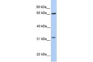 Western Blotting (WB) image for anti-PDZ Binding Kinase (PBK) antibody (ABIN2459238) (PBK antibody)