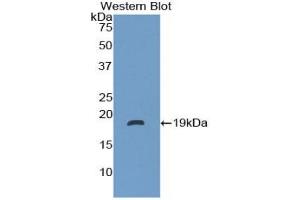 Detection of Recombinant NT, Human using Polyclonal Antibody to Neurotensin (NT) (Neurotensin antibody  (AA 42-167))