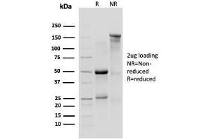 SDS-PAGE Analysis Purified IL-10R1 Rat Monoclonal Antibody (1B1. (IL-10RA antibody)