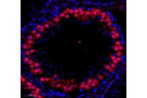 Immunofluorescence (Paraffin-embedded Sections) (IF (p)) image for anti-Stem-Loop Binding Protein (SLBP) antibody (ABIN7075733)