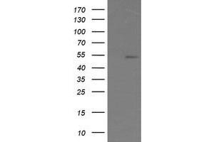 Image no. 2 for anti-ERG, ETS transcription factor (ERG) antibody (ABIN1498077) (ERG antibody)